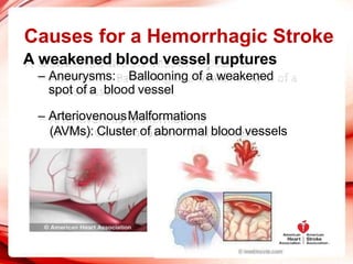 Causes for a Hemorrhagic Stroke
A weakened blood vessel ruptures
– Aneurysms: Ballooning of a weakened
spot of a blood vessel
– ArteriovenousMalformations
(AVMs): Cluster of abnormal blood vessels
 