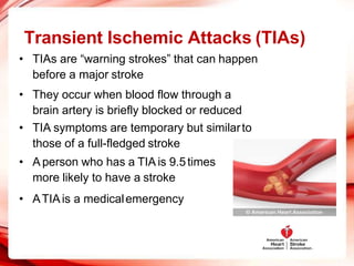 Transient Ischemic Attacks (TIAs)
• TIAs are “warning strokes” that can happen
before a major stroke
• They occur when blood flow through a
brain artery is briefly blocked or reduced
• TIA symptoms are temporary but similarto
those of a full-fledged stroke
• A person who has a TIA is 9.5times
more likely to have a stroke
• ATIAis a medicalemergency
 