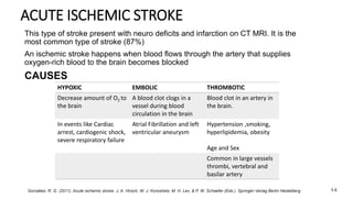 ACUTE ISCHEMIC STROKE
This type of stroke present with neuro deficits and infarction on CT MRI. It is the
most common type of stroke (87%)
An ischemic stroke happens when blood flows through the artery that supplies
oxygen-rich blood to the brain becomes blocked
CAUSES
HYPOXIC EMBOLIC THROMBOTIC
Decrease amount of O2 to
the brain
A blood clot clogs in a
vessel during blood
circulation in the brain
Blood clot in an artery in
the brain.
In events like Cardiac
arrest, cardiogenic shock,
severe respiratory failure
Atrial Fibrillation and left
ventricular aneurysm
Hypertension ,smoking,
hyperlipidemia, obesity
Age and Sex
Common in large vessels
thrombi, vertebral and
basilar artery
González, R. G. (2011). Acute ischemic stroke. J. A. Hirsch, W. J. Koroshetz, M. H. Lev, & P. W. Schaefer (Eds.). Springer-Verlag Berlin Heidelberg. 14
 
