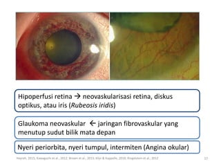 Stroke Hemodinamik | PDF
