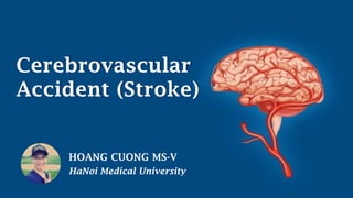 HOANG CUONG MS-V
HaNoi Medical University
Cerebrovascular
Accident (Stroke)
 