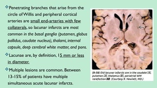 Penetrating branches that arise from the
circle of Willis and peripheral cortical
arteries are small end-arteries with few
collaterals, so lacunar infarcts are most
common in the basal ganglia (putamen, globus
pallidus, caudate nucleus), thalami, internal
capsule, deep cerebral white matter, and pons.
Lacunae are, by definition, 15 mm or less
in diameter.
Multiple lesions are common. Between
13-15% of patients have multiple
simultaneous acute lacunar infarcts.
 