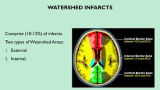 WATERSHED INFARCTS
Comprise (10-12%) of infarcts.
Two types ofWatershed Areas:
1. External
2. Internal.
 