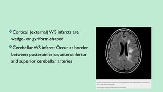 Cortical (external)WS infarcts are
wedge- or gyriform-shaped
CerebellarWS infarct: Occur at border
between posteroinferior, anteroinferior
and superior cerebellar arteries
 