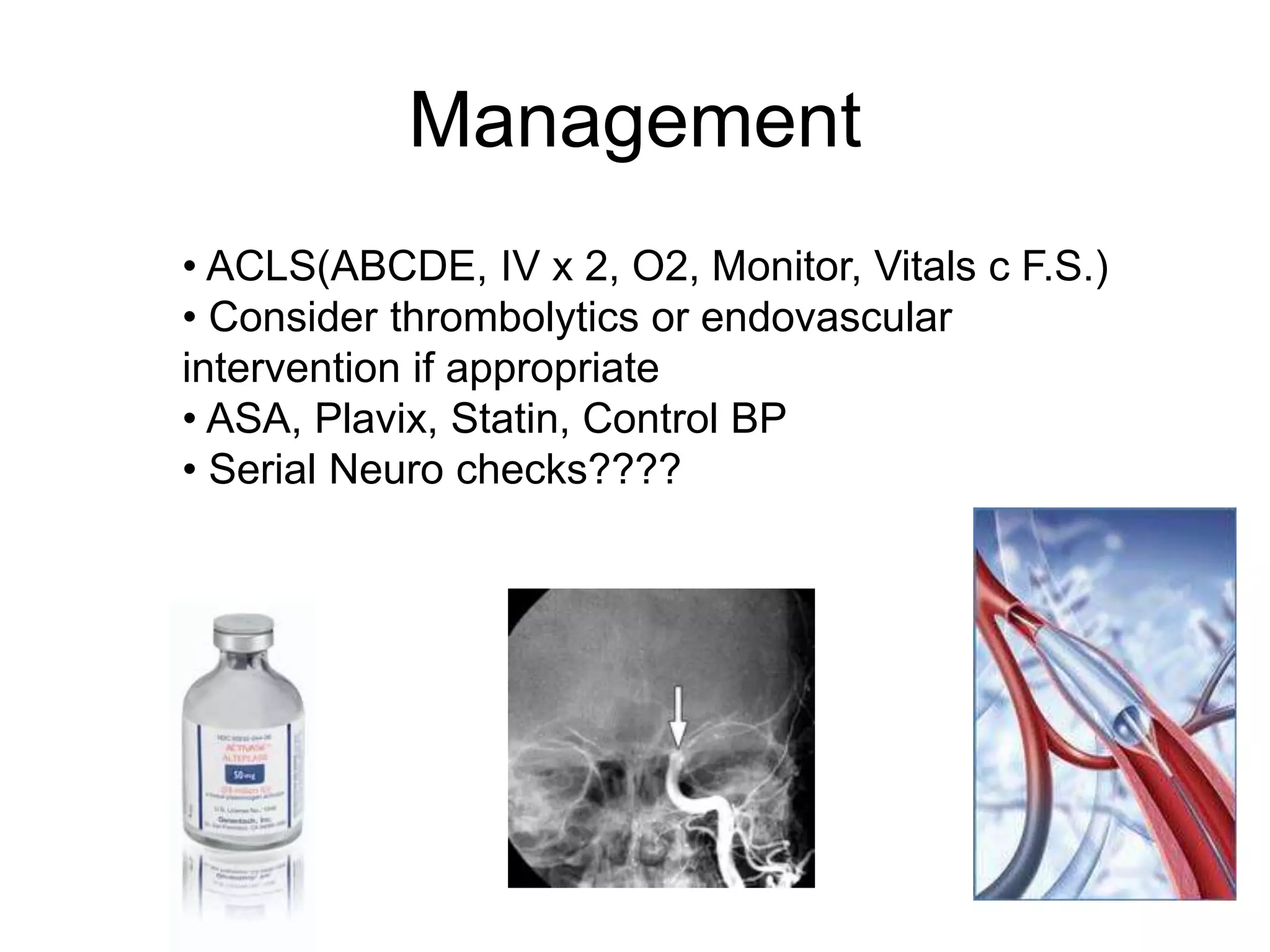 • ACLS(ABCDE, IV x 2, O2, Monitor, Vitals c F.S.)
• Consider thrombolytics or endovascular
intervention if appropriate
• ASA, Plavix, Statin, Control BP
• Serial Neuro checks????
Management
 