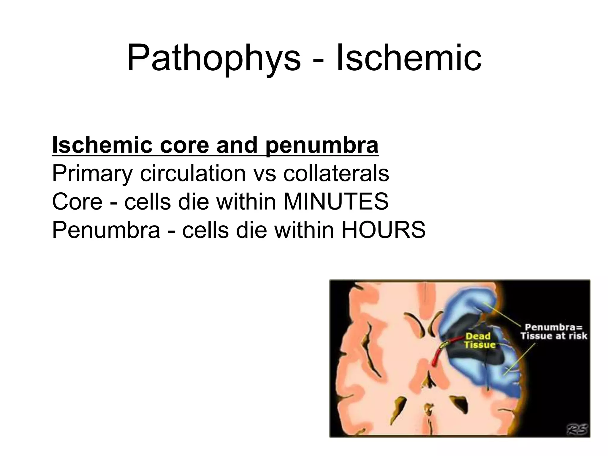 Pathophys - Ischemic
Ischemic core and penumbra
Primary circulation vs collaterals
Core - cells die within MINUTES
Penumbra - cells die within HOURS
 