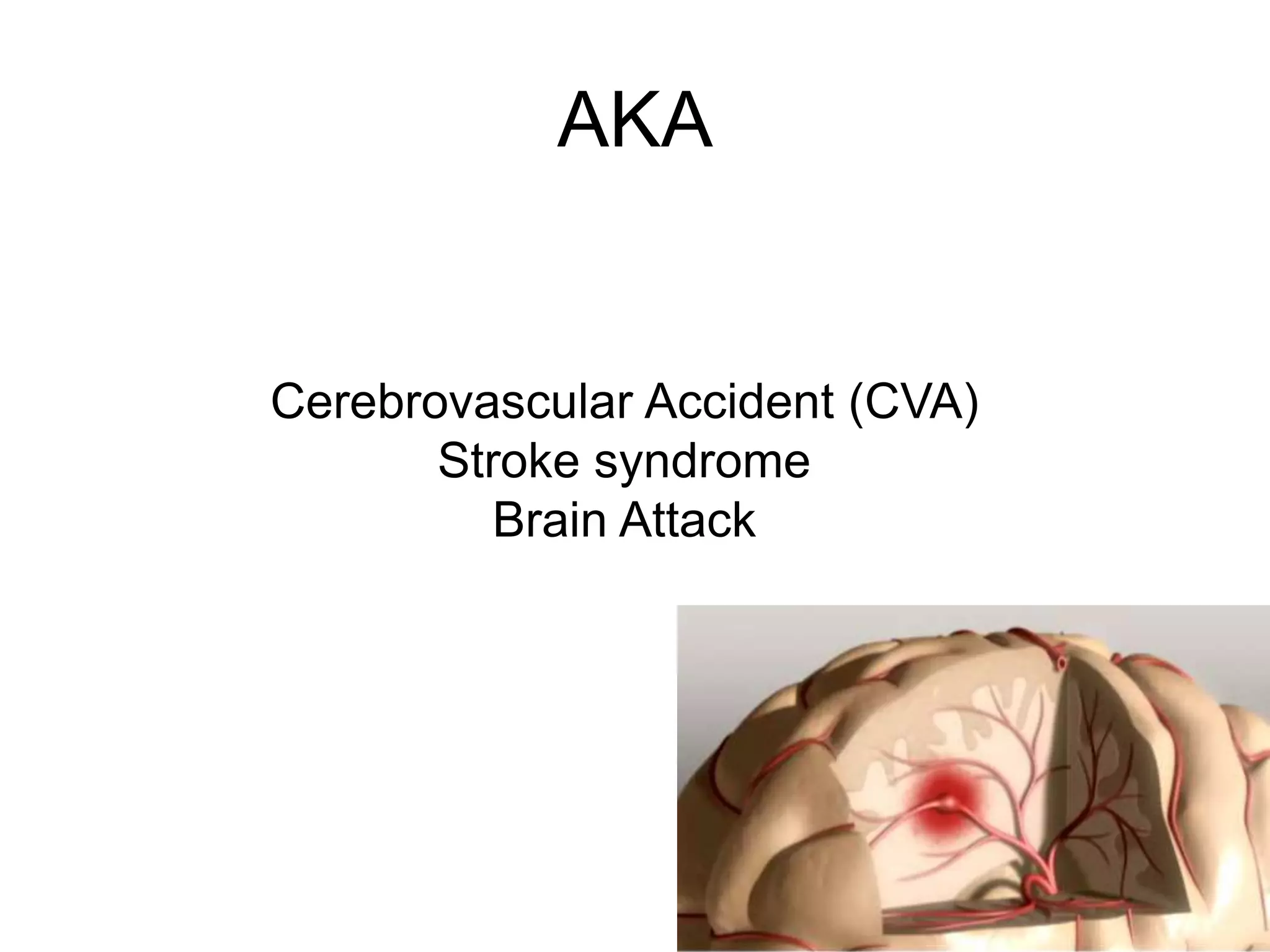 Cerebrovascular Accident (CVA)
Stroke syndrome
Brain Attack
AKA
 
