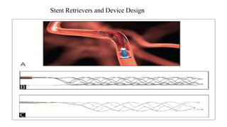 Stent Retrievers and Device Design
 