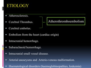 ETIOLOGY
 Atherosclerosis.
 Cerebral Thrombus.
 Cerebral embolus.
 Embolism from the heart (cardiac origin)
 Intracranial hemorrhage.
 Subarachnoid hemorrhage.
 Intracranial small vessel disease.
 Arterial aneurysms and Arterio-venous malformation.
 Haematological disorders (haemoglobinopathies, leukemia)
Atherothromboembolism
 