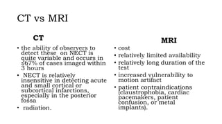 Ischemic Stroke investigations | PPTX
