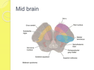 Stroke localization by Dr. Md. firoz | PPTX