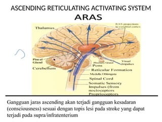 STROKE LOCOMMATION jjhdbsuuainnxvvv.pptx