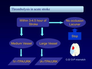 Thrombolysis in acute stroke


      Within 3-4.5 hour of         No occlusion
             Stroke                  Lacunar


                                        Stop

Medium Vessel       Large Vessel




                                   C-D/ D-P mismatch
 IV rTPA/URK         IA rTPA/URK
 