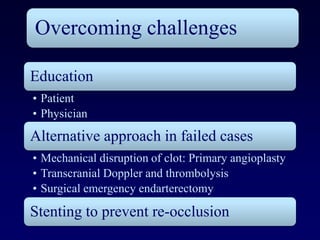 Overcoming challenges

Education
• Patient
• Physician
Alternative approach in failed cases
• Mechanical disruption of clot: Primary angioplasty
• Transcranial Doppler and thrombolysis
• Surgical emergency endarterectomy

Stenting to prevent re-occlusion
 