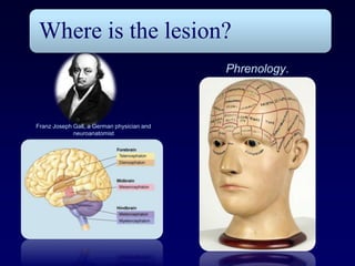 Where is the lesion?
                                            Phrenology.



Franz Joseph Gall, a German physician and
             neuroanatomist
 