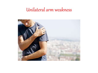 Unilateral arm weakness
 
