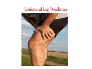 Unilateral Leg Weakness
 