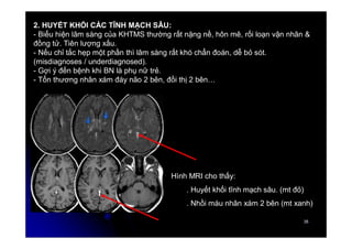 35
35
2. HUYẾT KHỐI CÁC TĨNH MẠCH SÂU:
- Biểu hiện lâm sàng của KHTMS thường rất nặng nề, hôn mê, rối loạn vận nhãn &
đồng tử. Tiên lượng xấu.
- Nếu chỉ tắc hẹp một phần thì lâm sàng rất khó chẩn đoán, dễ bỏ sót.
(misdiagnoses / underdiagnosed).
- Gợi ý đến bệnh khi BN là phụ nữ trẻ.
- Tổn thương nhân xám đáy não 2 bên, đồi thị 2 bên…
Hình MRI cho thấy:
. Huyết khối tĩnh mạch sâu. (mt đỏ)
. Nhồi máu nhân xám 2 bên (mt xanh)
 