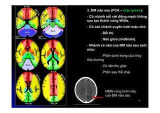 5
5
3. ĐM não sau (PCA – màu green):
- Có nhánh nối với động mạch thông
sau tạo thành vòng Willis.
- Có các nhánh xuyên tưới máu cho:
. Đồi thị
. Não giữa (midbrain).
- Nhánh vỏ não của ĐM não sau tưới
máu:
. Phần dưới trong của thùy
thái dương
. Vỏ não thụ giác
. Phần sau thể chai.
NMN vùng tưới máu
của ĐM não sau
 
