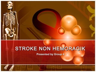 STROKE NON HEMORAGIKSTROKE NON HEMORAGIK
Presented by Group 4Presented by Group 4
 