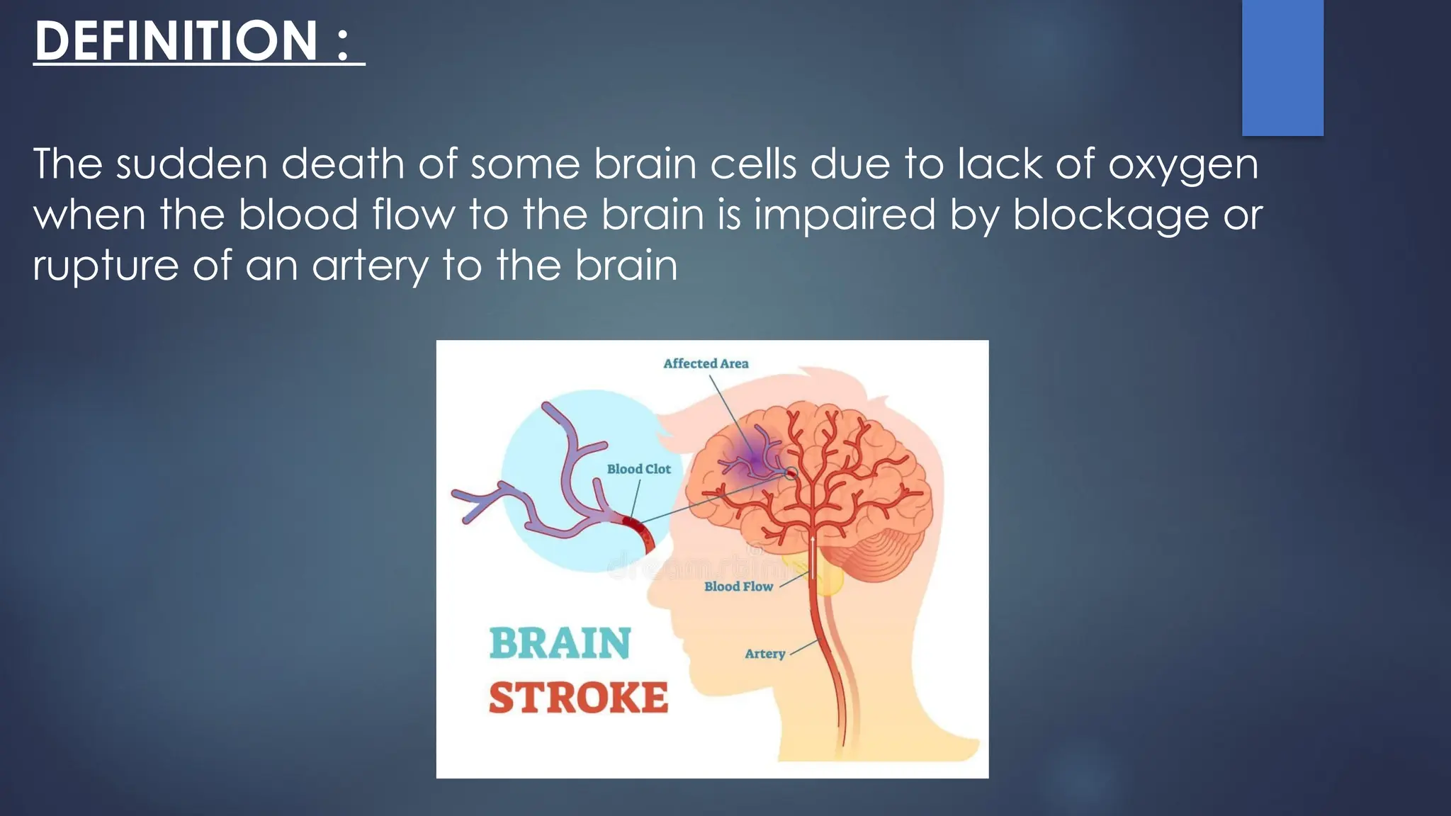 DEFINITION :
The sudden death of some brain cells due to lack of oxygen
when the blood flow to the brain is impaired by blockage or
rupture of an artery to the brain
 