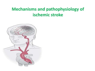 Mechanisms and pathophysiology of
ischemic stroke
 
