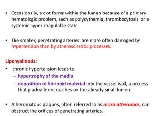 • Occasionally, a clot forms within the lumen because of a primary
hematologic problem, such as polycythemia, thrombocytosis, or a
systemic hyper coagulable state.
• The smaller, penetrating arteries are more often damaged by
hypertension than by atherosclerotic processes.
Lipohyalinosis:
• chronic hypertension leads to
– hypertrophy of the media
– deposition of fibrinoid material into the vessel wall, a process
that gradually encroaches on the already small lumen.
• Atheromatous plaques, often referred to as micro atheromas, can
obstruct the orifices of penetrating arteries.
 