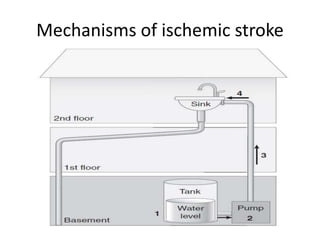 Mechanisms of ischemic stroke
 