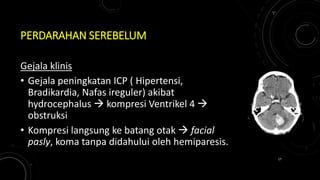 PERDARAHAN SEREBELUM
Gejala klinis
• Gejala peningkatan ICP ( Hipertensi,
Bradikardia, Nafas ireguler) akibat
hydrocephalus  kompresi Ventrikel 4 
obstruksi
• Kompresi langsung ke batang otak  facial
pasly, koma tanpa didahului oleh hemiparesis.
17
 