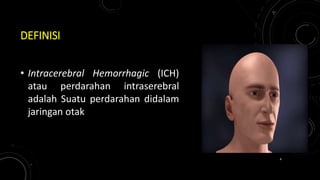 DEFINISI
• Intracerebral Hemorrhagic (ICH)
atau perdarahan intraserebral
adalah Suatu perdarahan didalam
jaringan otak
4
 