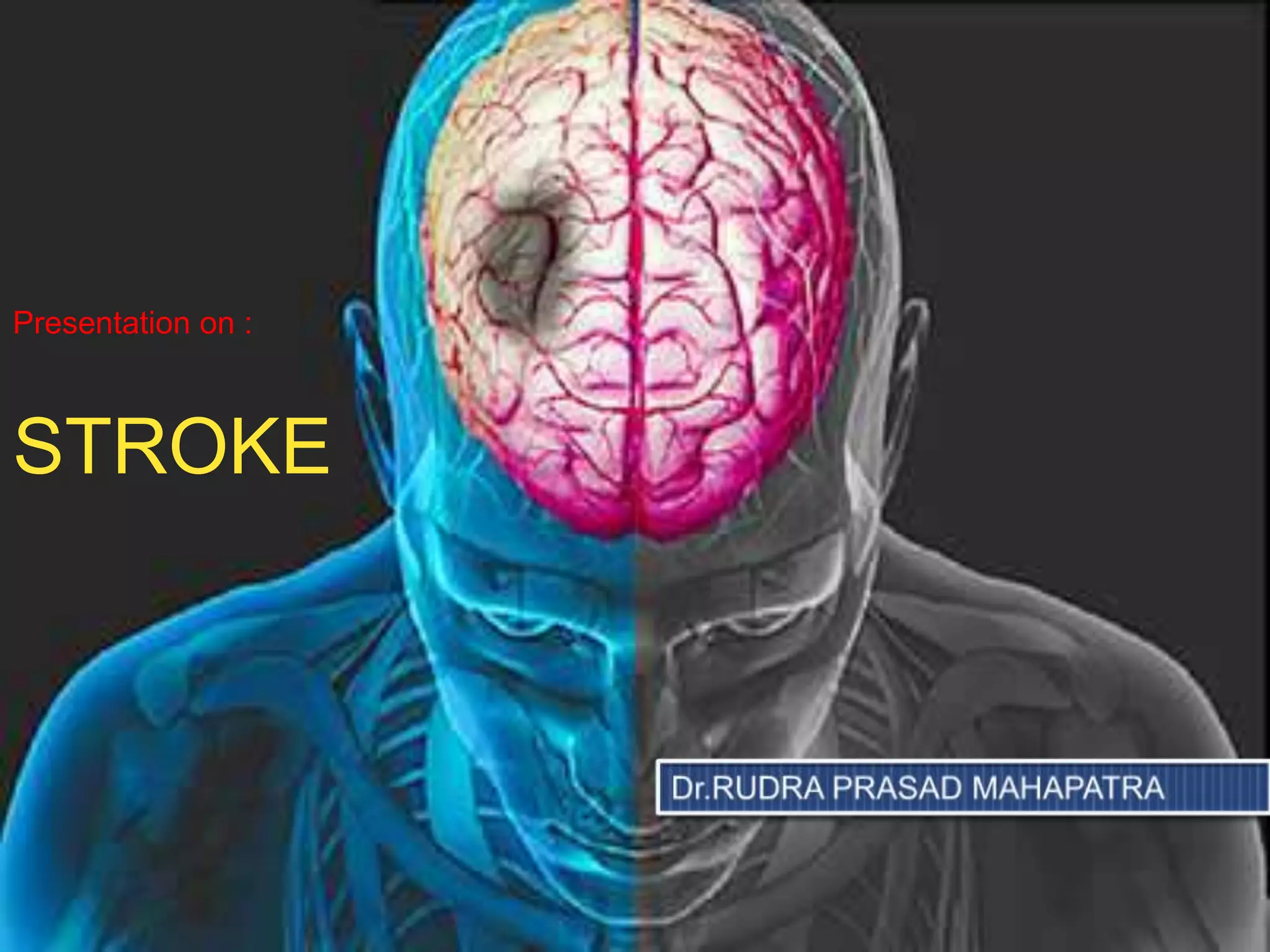 Stroke Ppt Pptx