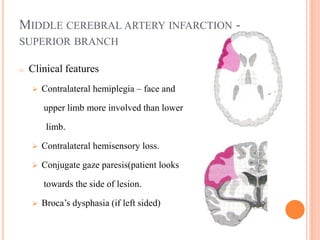 MIDDLE CEREBRAL ARTERY INFARCTION -
SUPERIOR BRANCH
o Clinical features
 Contralateral hemiplegia – face and
upper limb more involved than lower
limb.
 Contralateral hemisensory loss.
 Conjugate gaze paresis(patient looks
towards the side of lesion.
 Broca’s dysphasia (if left sided)
 