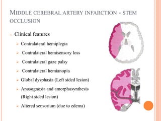 MIDDLE CEREBRAL ARTERY INFARCTION - STEM
OCCLUSION
o Clinical features
 Contralateral hemiplegia
 Contralateral hemisensory loss
 Contralateral gaze palsy
 Contralateral hemianopia
 Global dysphasia (Left sided lesion)
 Anosognosia and amorphosynthesis
(Right sided lesion)
 Altered sensorium (due to edema)
 