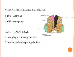 MEDIAL MEDULLARY SYNDROME
A.IPSILATERAL
1.XIIth nerve palsy
B.CONTRALATERAL
1.Hemiplegia – sparing the face
2.Hemianaesthesia sparing the face.
 