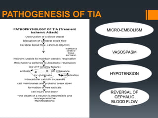 PATHOGENESIS OF TIA
MICRO-EMBOLISM
VASOSPASM
HYPOTENSION
REVERSAL OF
CEPHALIC
BLOOD FLOW
 