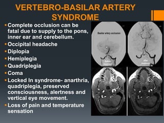 VERTEBRO-BASILAR ARTERY
SYNDROME
Complete occlusion can be
fatal due to supply to the pons,
inner ear and cerebellum.
Occipital headache
Diplopia
Hemiplegia
Quadriplegia
Coma
Locked In syndrome- anarthria,
quadriplegia, preserved
consciousness, alertness and
vertical eye movement.
Loss of pain and temperature
sensation
 