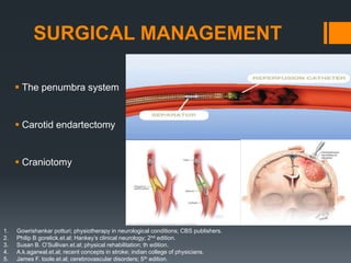 SURGICAL MANAGEMENT
 The penumbra system
 Carotid endartectomy
 Craniotomy
1. Gowrishankar potturi; physiotherapy in neurological conditions; CBS publishers.
2. Philip B gorelick.et.al; Hankey’s clinical neurology; 2nd edition.
3. Susan B. O’Sullivan.et.al; physical rehabilitation; th edition.
4. A.k.agarwal.et.al; recent concepts in stroke; indian college of physicians.
5. James F. toole.et.al; cerebrovascular disorders; 5th edition.
 