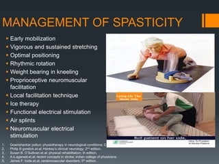 MANAGEMENT OF SPASTICITY
 Early mobilization
 Vigorous and sustained stretching
 Optimal positioning
 Rhythmic rotation
 Weight bearing in kneeling
 Proprioceptive neuromuscular
facilitation
 Local facilitation technique
 Ice therapy
 Functional electrical stimulation
 Air splints
 Neuromuscular electrical
stimulation
1. Gowrishankar potturi; physiotherapy in neurological conditions; CBS publishers.
2. Philip B gorelick.et.al; Hankey’s clinical neurology; 2nd edition.
3. Susan B. O’Sullivan.et.al; physical rehabilitation; th edition.
4. A.k.agarwal.et.al; recent concepts in stroke; indian college of physicians.
5. James F. toole.et.al; cerebrovascular disorders; 5th edition.
 