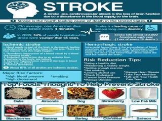strokepresentation-170712173032.ppt