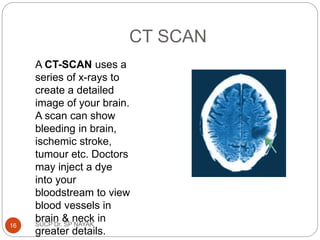 CT SCAN
A CT-SCAN uses a
series of x-rays to
create a detailed
image of your brain.
A scan can show
bleeding in brain,
ischemic stroke,
tumour etc. Doctors
may inject a dye
into your
bloodstream to view
blood vessels in
brain & neck in
greater details.
SUCP Dr. SP NAYAK
16
 