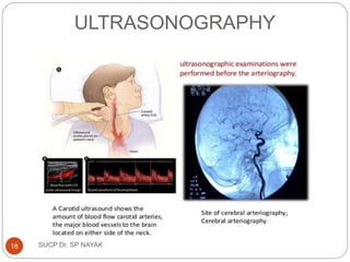 ULTRASONOGRAPHY
SUCP Dr. SP NAYAK
18
 