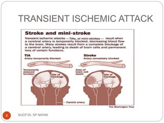 TRANSIENT ISCHEMIC ATTACK
SUCP Dr. SP NAYAK
8
 