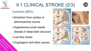 Small Deep Cryptogenic Infarct Stroke prevention | PDF