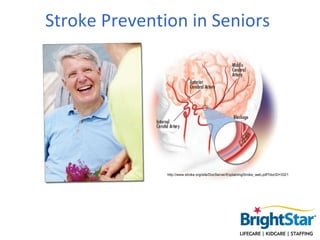 Stroke Prevention in Seniors




               http://www.stroke.org/site/DocServer/ExplainingStroke_web.pdf?docID=3321
 