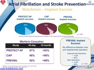 Atrial Fibrillation and Stroke Prevention
Watchman – Implant Success
p = 0.04
Study 45-day 12-month
PROTECT AF 87% >93%
CAP 96% >96%
PREVAIL 92% >99%
Implant success defined as deployment and release of the device into the left atrial appendage
Warfarin Cessation PREVAIL Implant
Success
No difference between new
and experienced operators
Experienced Operators
• n=26
• 96%
New Operators
• n=24
• 93% p = 0.28
PROTECT AF and CAP: Reddy, VY et al. Circulation. 2011;123:417-424.
PREVAIL: Holmes, DR et al. JACC 2014; 64(1):1-12.
www.theafibclinic.com
 