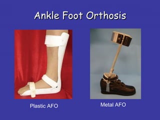 Plastic AFO Metal AFO
Ankle Foot OrthosisAnkle Foot Orthosis
 