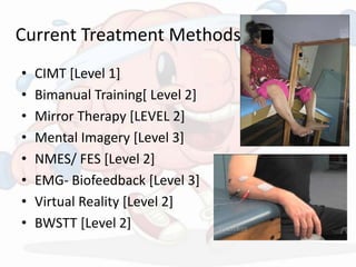 Current Treatment Methods
• CIMT [Level 1]
• Bimanual Training[ Level 2]
• Mirror Therapy [LEVEL 2]
• Mental Imagery [Level 3]
• NMES/ FES [Level 2]
• EMG- Biofeedback [Level 3]
• Virtual Reality [Level 2]
• BWSTT [Level 2]
 