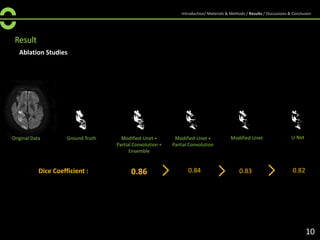 Result
Ablation Studies
Original Data Modified-Unet +
Partial Convolution +
Ensemble
U-NetModified-Unet +
Partial Convolution
Modified-UnetGround Truth
0.86 0.820.830.84Dice Coefficient :
10
Introduction/ Materials & Methods / Results / Discussions & Conclusion
 