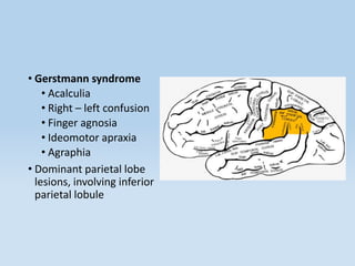 • Gerstmann syndrome
• Acalculia
• Right – left confusion
• Finger agnosia
• Ideomotor apraxia
• Agraphia
• Dominant parietal lobe
lesions, involving inferior
parietal lobule
 