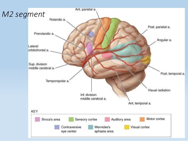stroke syndromes